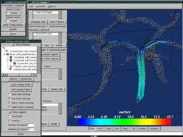 carotid_stream